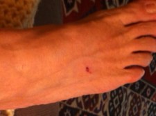 The dangers of cutting rulers